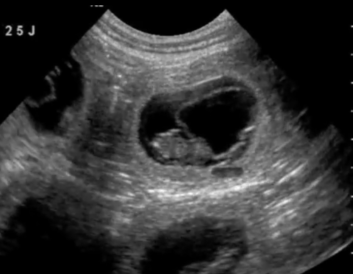 Les futurs bébés sont en route!